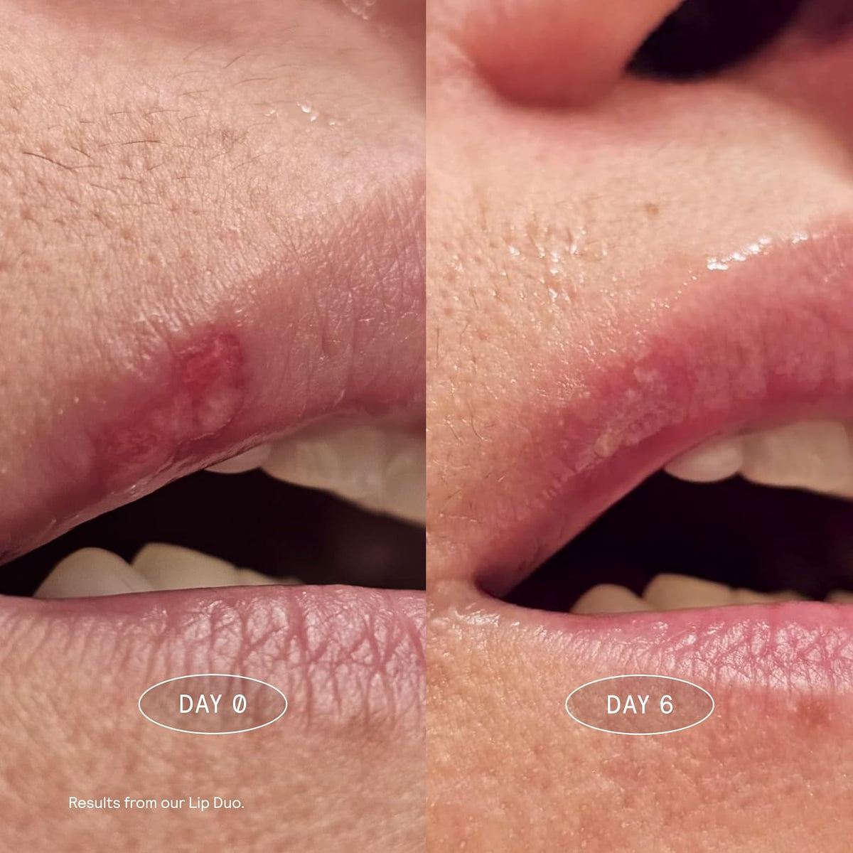 MARK Los Angeles Bálsamo labial para labios secos agrietados | Repa...