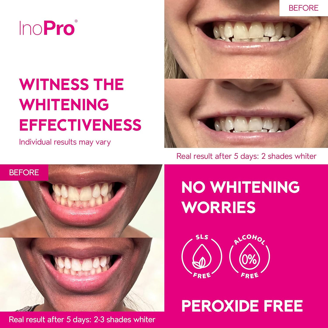 InoPro Kit de 21 tiras blanqueadoras dentales, blanqueador de dient...