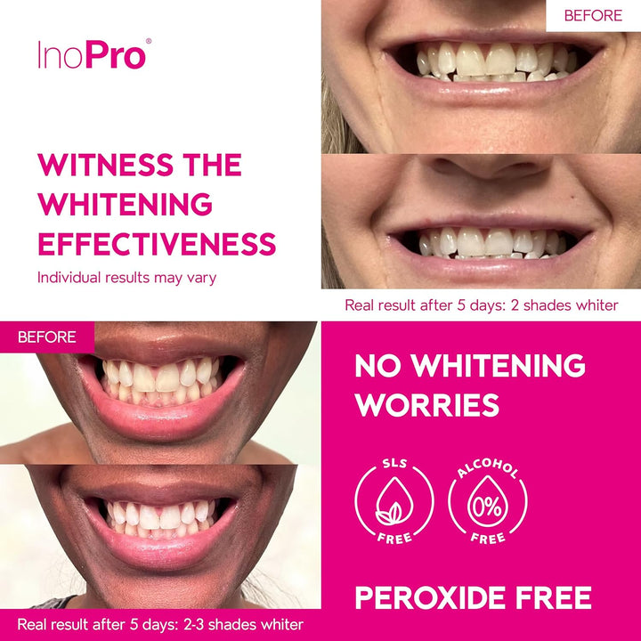 InoPro Kit de 21 tiras blanqueadoras dentales, blanqueador de dient...