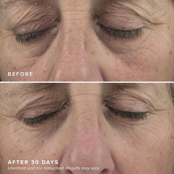 DRMTLGY Mascarillas iluminadoras para los ojos \u2013 Parches biode...