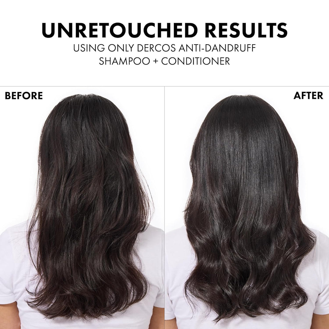 Dercos Dandruff Shampoo, Antifungal Dry Scalp Treatment &amp; Itchy...