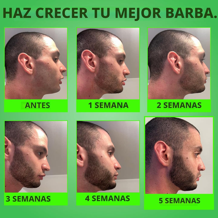 Minoxidil para el crecimiento de la barba: suero al 5% con 2 veces...