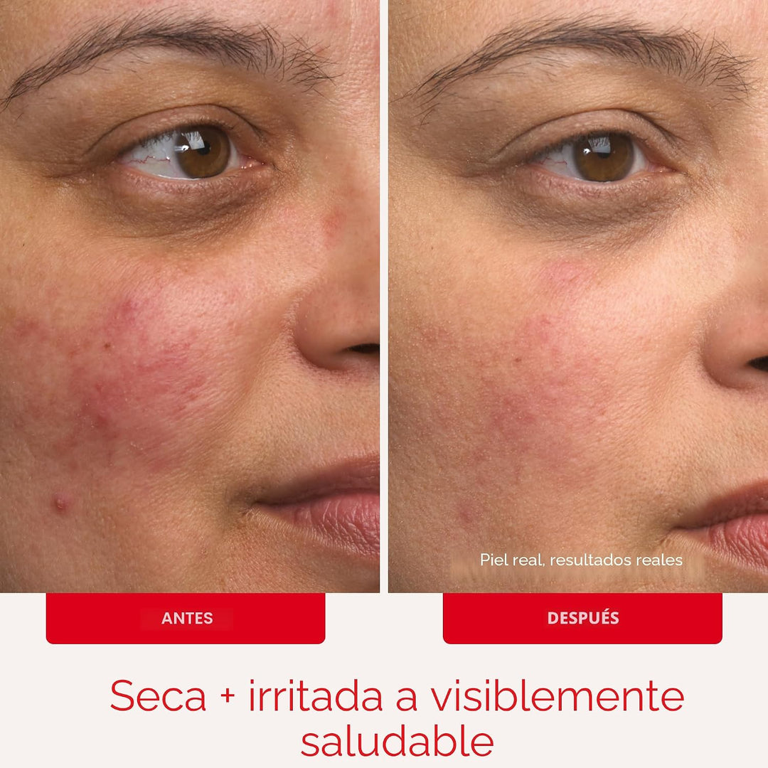Crema ultra reparadora First Aid Beauty, hidratación intensa, humec...