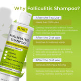Champú antifúngico para foliculitis, dermatitis seborreica, caspa,...