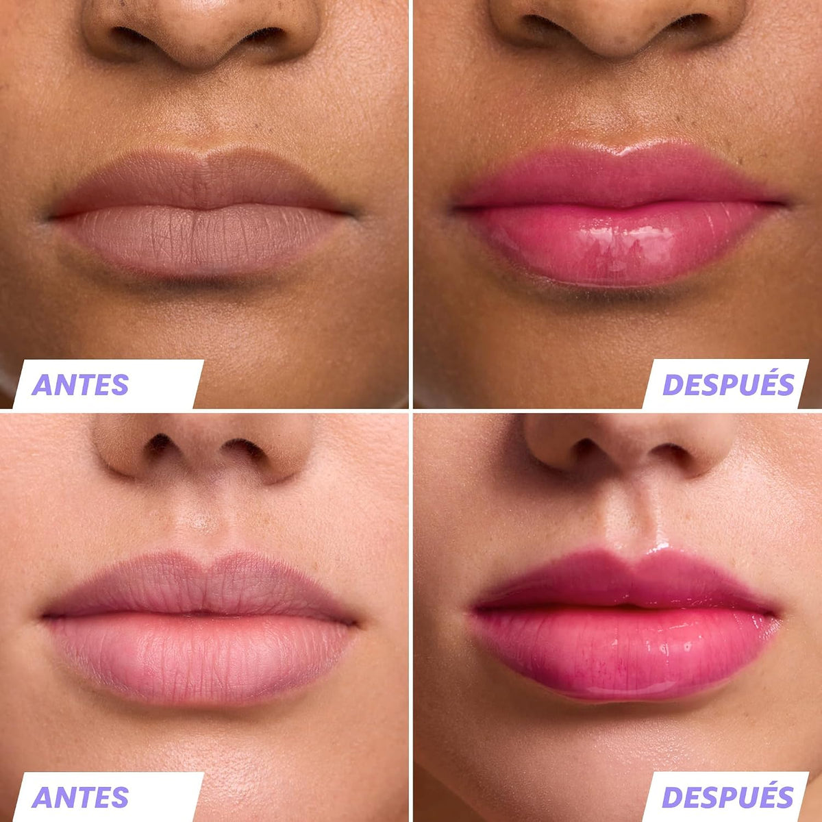 Wonderskin Sérum de rehabilitación de aceite de labios \u2013 Aceit...