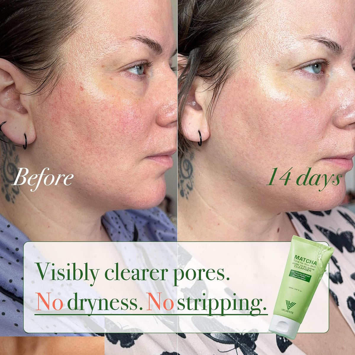 VELVENTE Matcha Rose PDRN - Jabón facial coreano, limpiador hidrata...