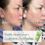 VELVENTE Matcha Rose PDRN - Jabón facial coreano, limpiador hidrata...