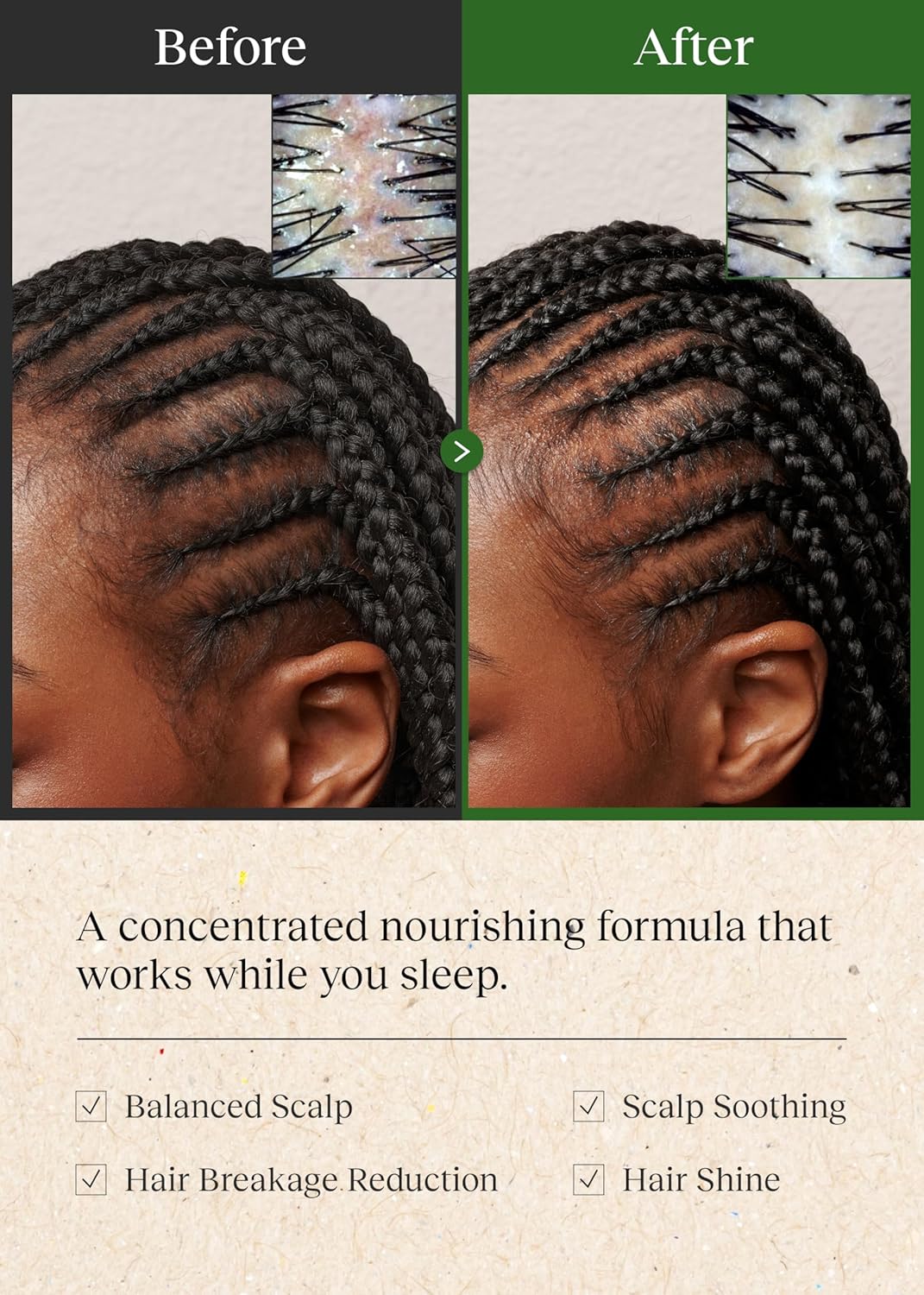 Bephor Braid Rev Scalp - Bálsamo de aceite para dormir, tratamiento...