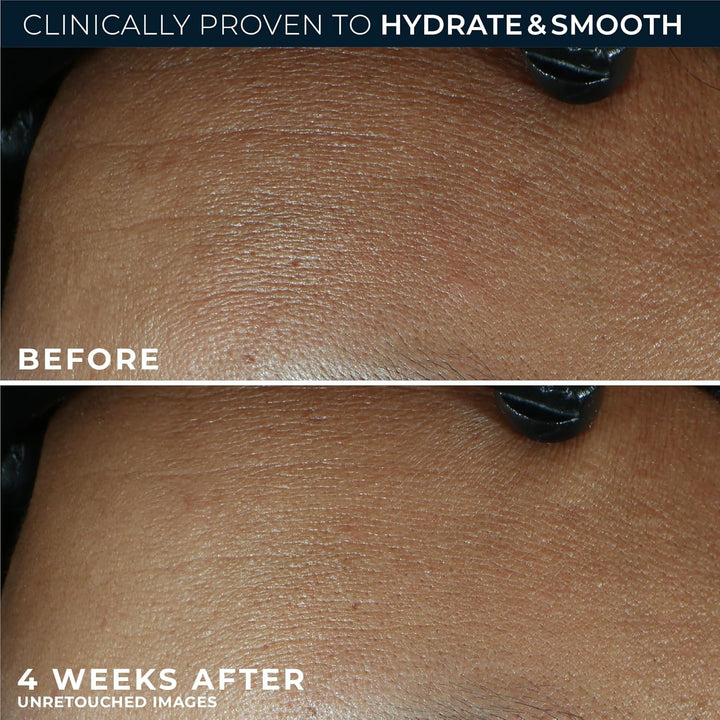 RoC Retinol Correxion Max Hydration - Hidratante facial diario anti...