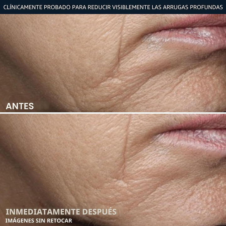 RoC Crema Rica para Arrugas Profundas, Sin Fragancia, Crema Reafirm...