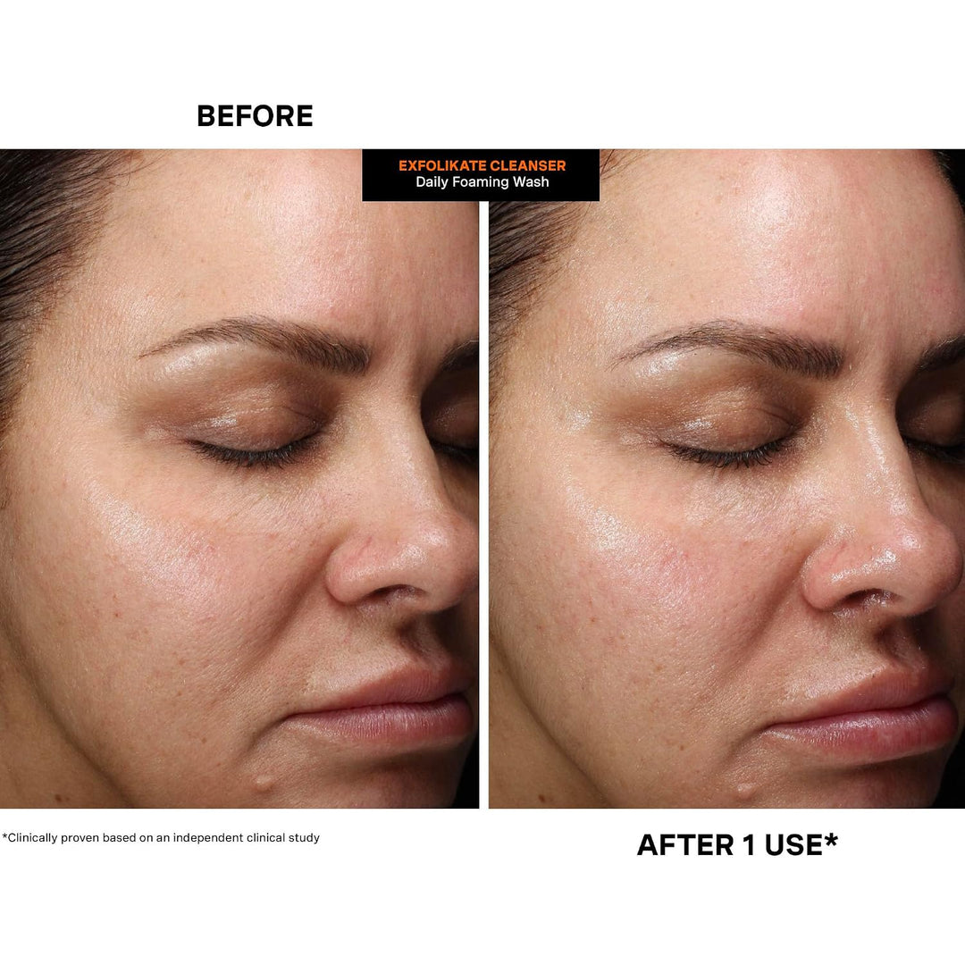 Kate Somerville ExfoliKate Limpiador \u2013 Lavado facial exfoliant...