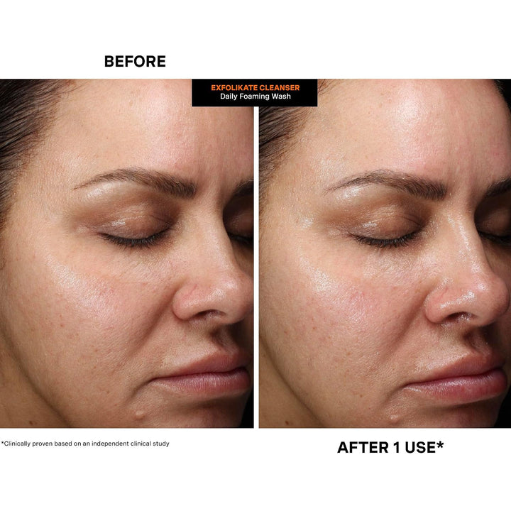 Kate Somerville ExfoliKate Limpiador \u2013 Lavado facial exfoliant...