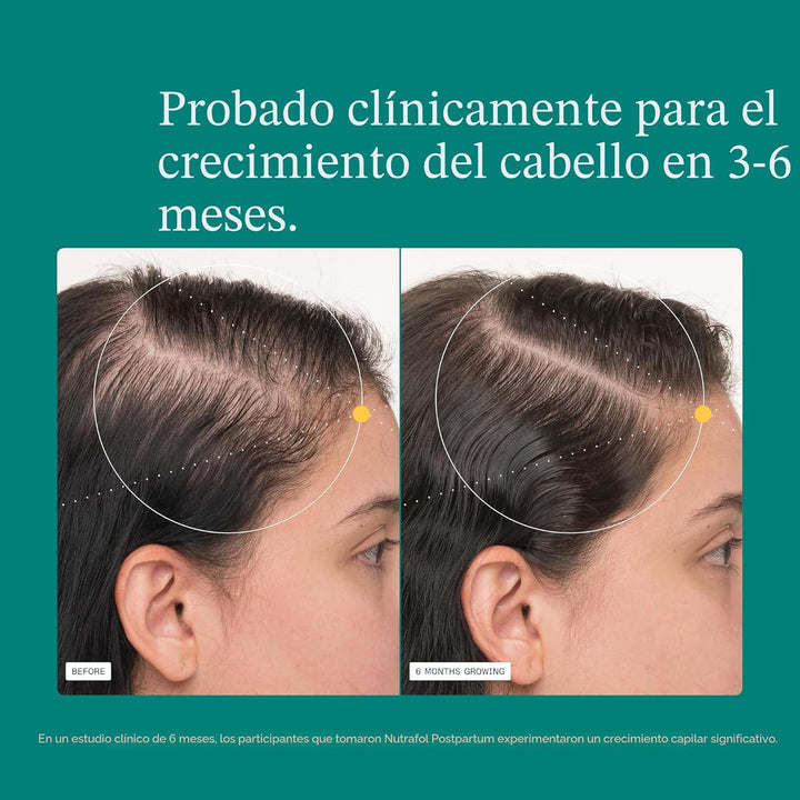 Nutrafol - Suplementos de crecimiento del cabello posparto, clínica...