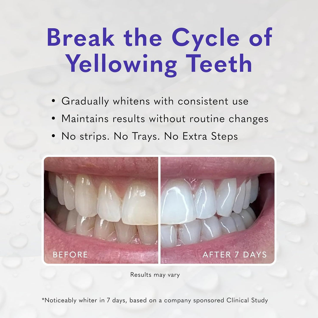 Gel blanqueador de dientes Smileactives, peróxido de hidrógeno de g...