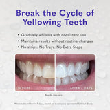 Gel blanqueador de dientes Smileactives, peróxido de hidrógeno de g...