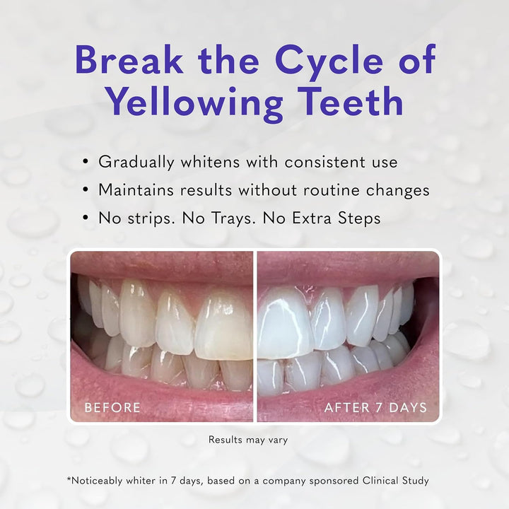 Gel blanqueador de dientes Smileactives, peróxido de hidrógeno de g...
