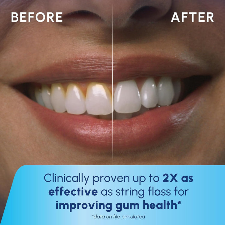 Waterpik - Irrigador inalámbrico Express, funciona con baterías y e...