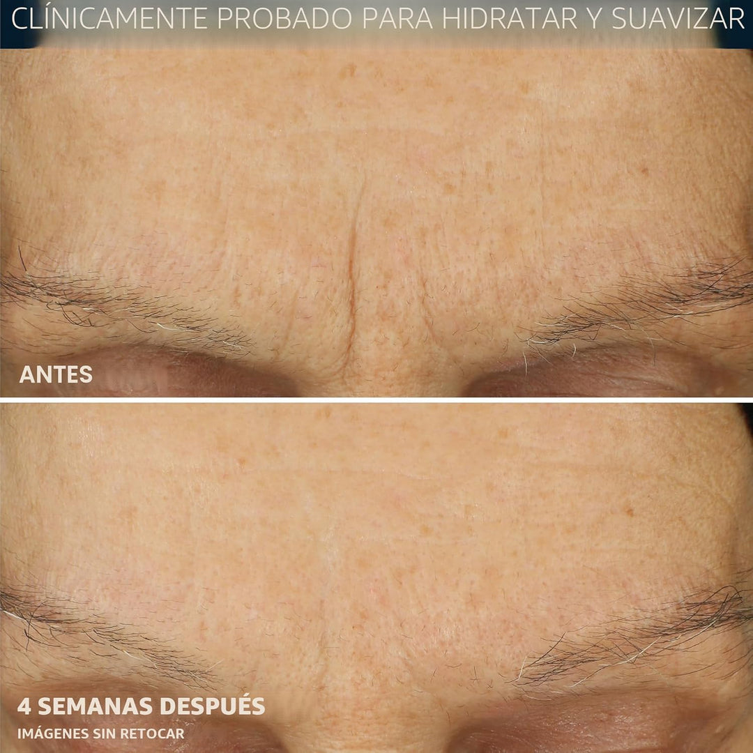 RoC Retinol Correxion Max Hidratación diaria hidratante facial anti...