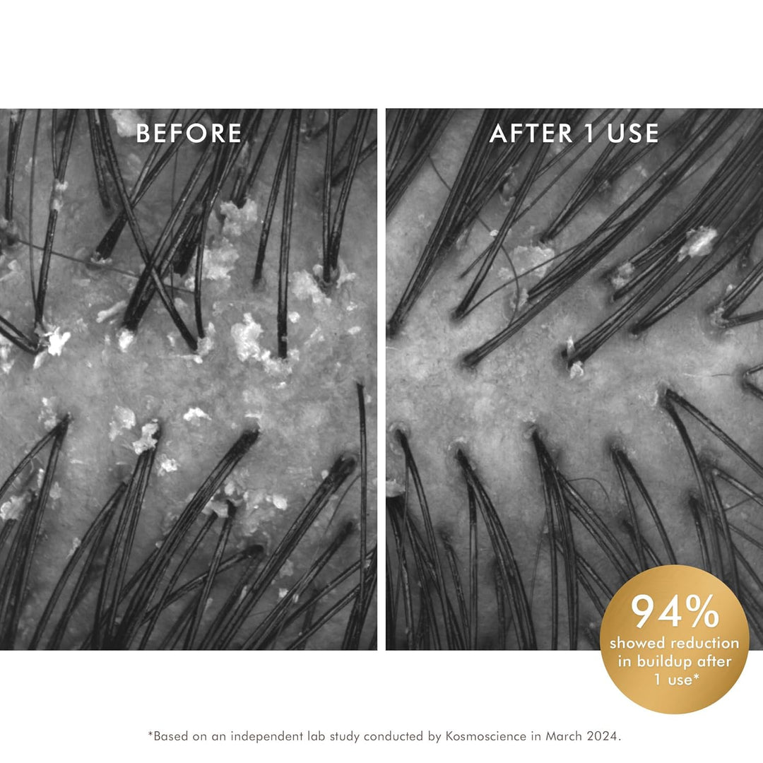 Moroccanoil Exfoliante purificador prelavado para el cuero cabellud...
