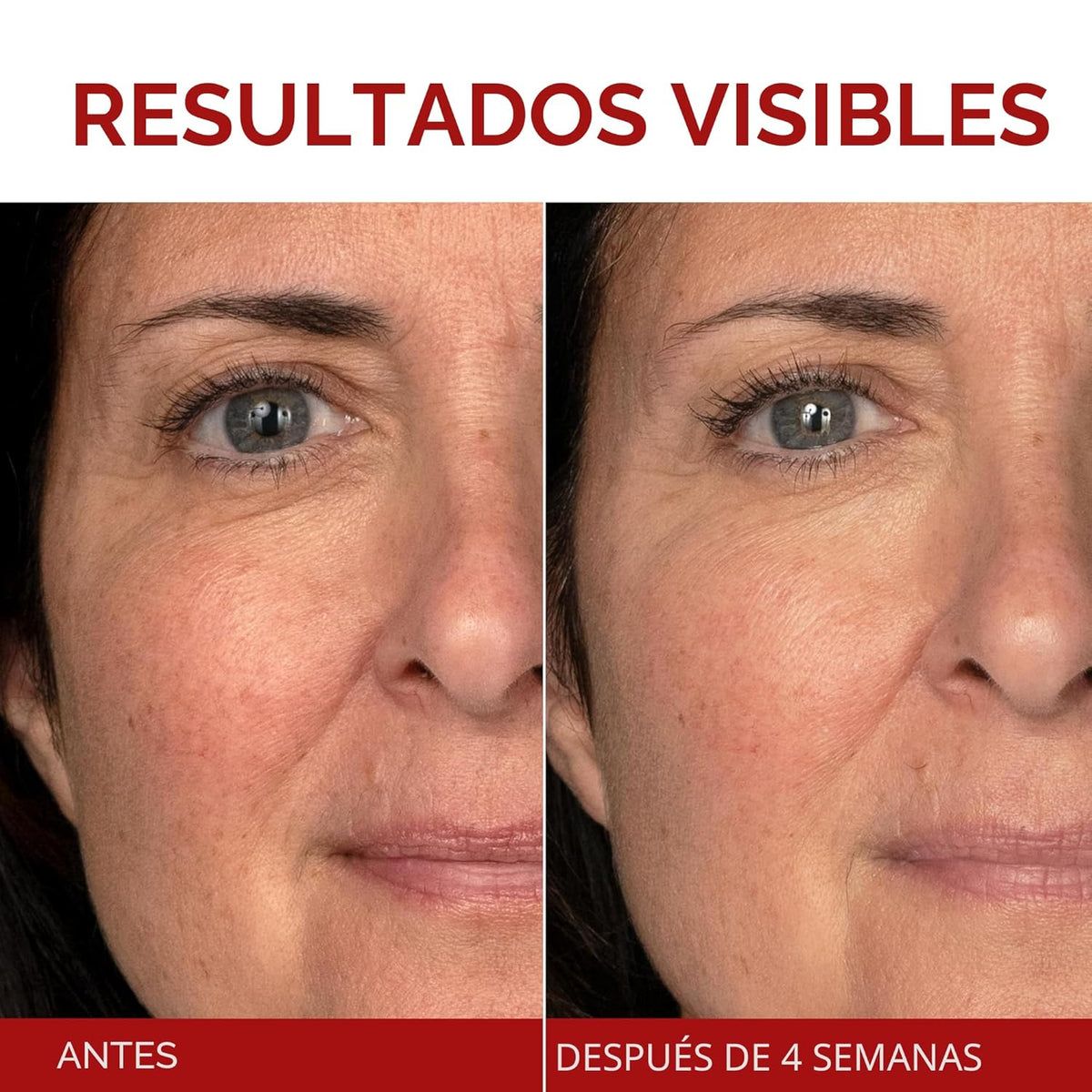 L'Oreal Paris Revitalift Triple Power Crema Hidratante Facial A...