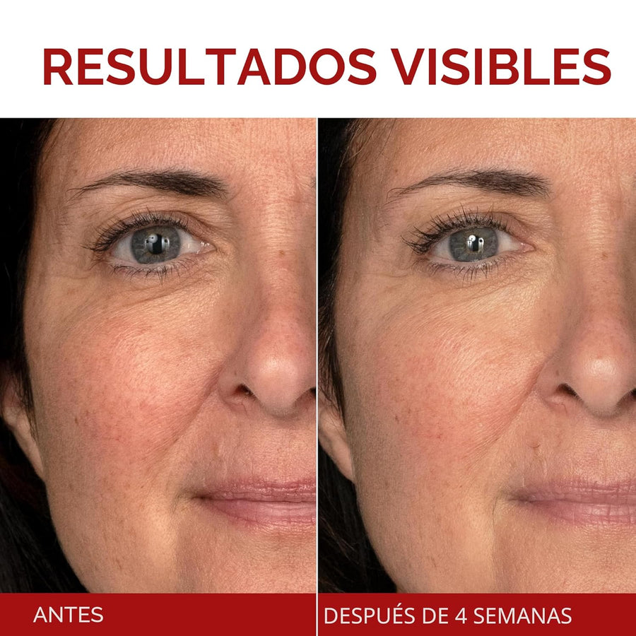 L'Oreal Paris Revitalift Triple Power Crema Hidratante Facial A...