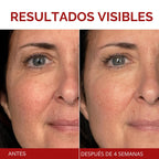 L'Oreal Paris Revitalift Triple Power Crema hidratante facial a...