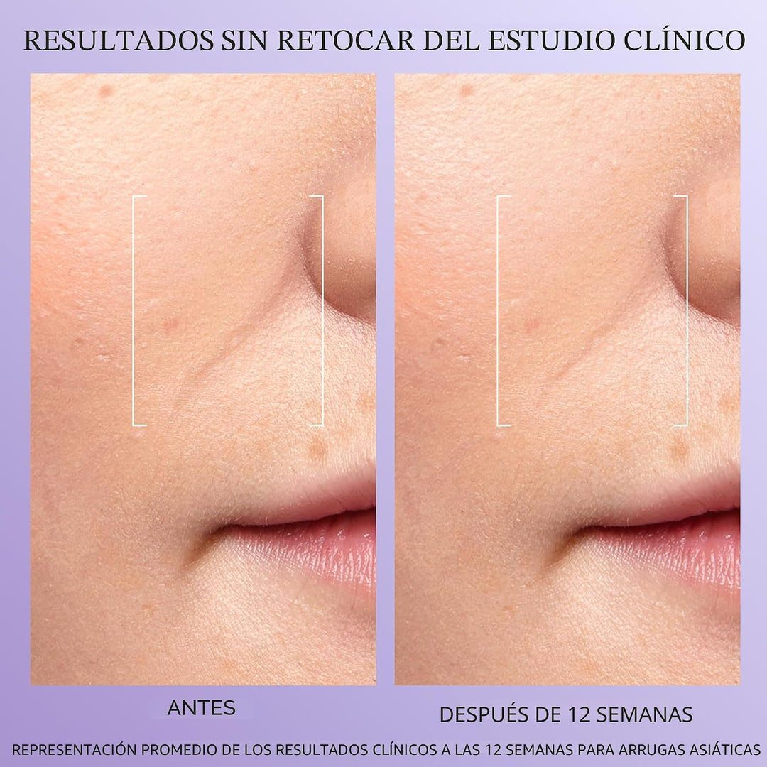 Lancôme Rénergie H.C.F. Triple Serum - Suero de ácido hialurónico p...
