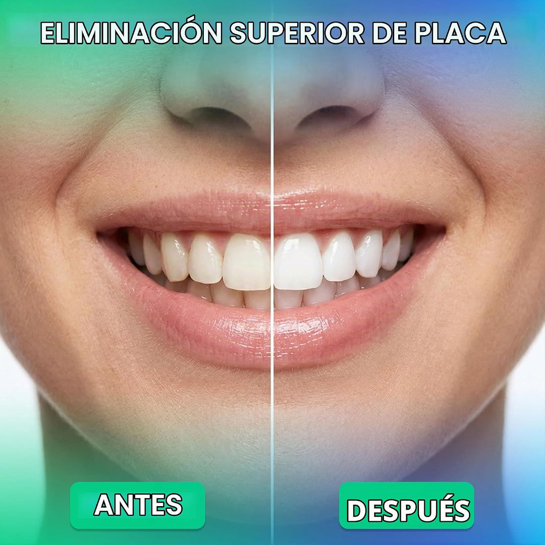 Puur Smile Irrigador Dental Profesional de Agua \u2013 Cuidado dent...