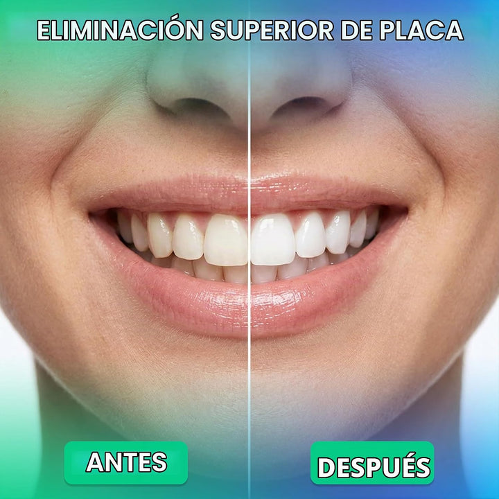 Puur Smile Irrigador Dental Profesional de Agua \u2013 Cuidado dent...