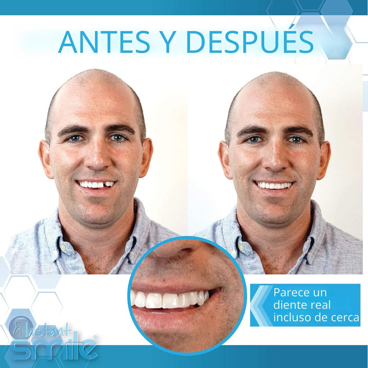 Instant Smile Completa tu sonrisa, kit temporal de reemplazo de die...