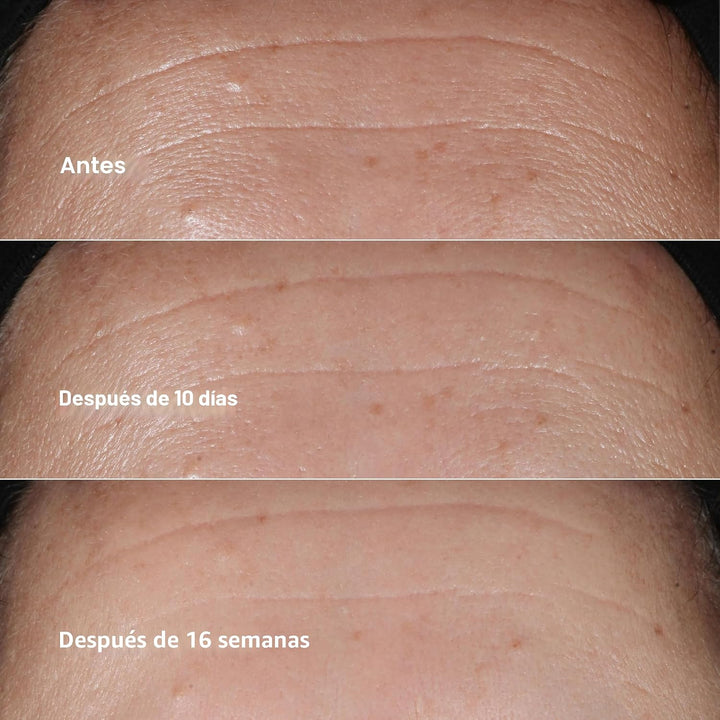 Clinique Smart Clinical Repair Suero facial antienvejecimiento corr...