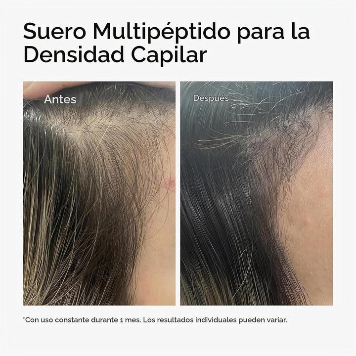 El suero multipéptido ordinario para la densidad del cabello, fórmu...