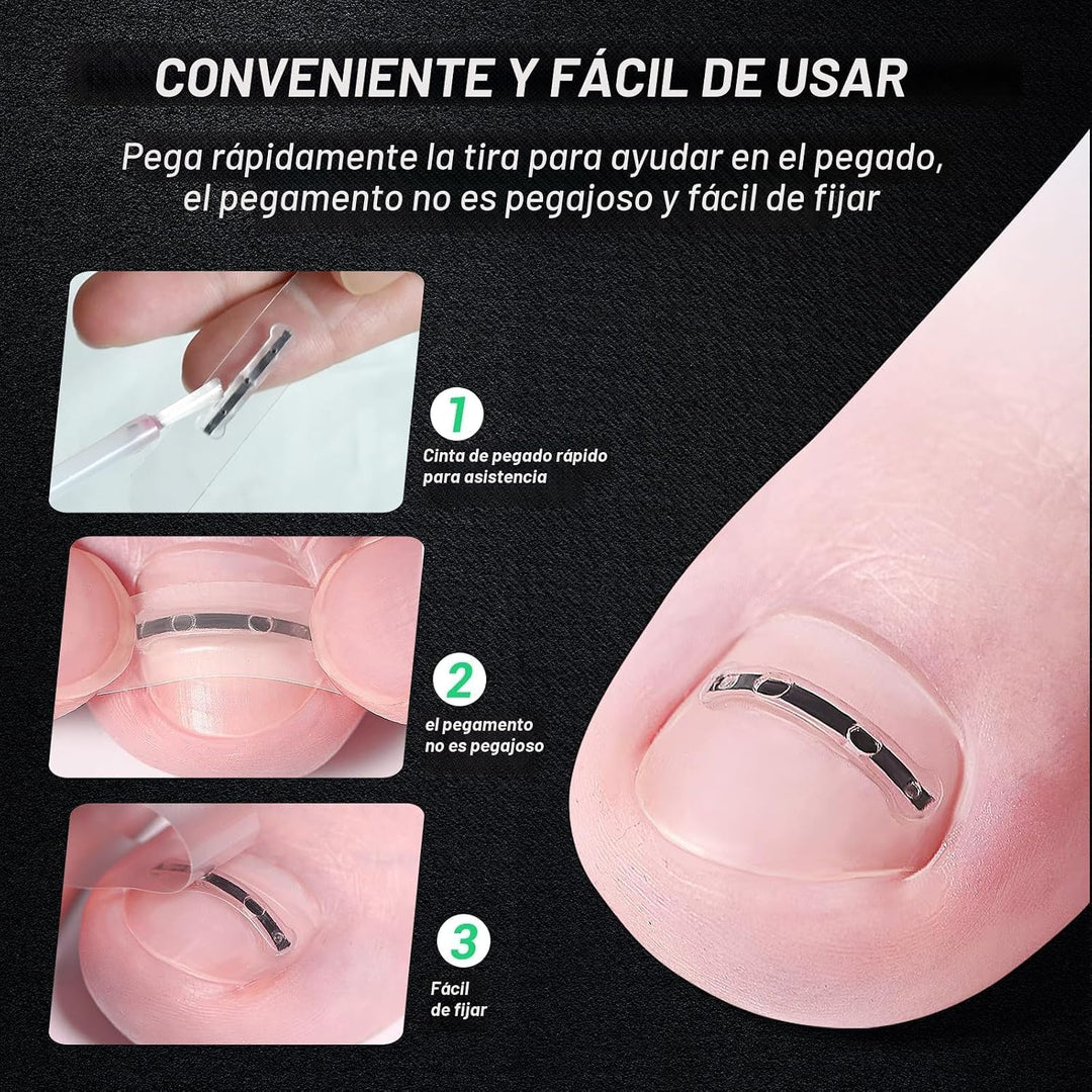 Reieset Tratamiento de uñas encarnadas de aleación de titanio, herr...