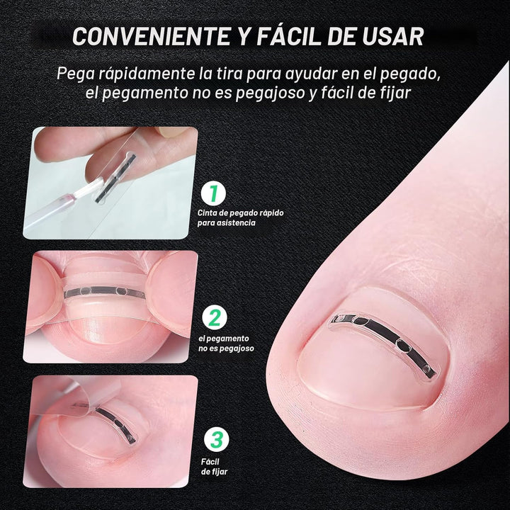 Reieset Tratamiento de uñas encarnadas de aleación de titanio, herr...