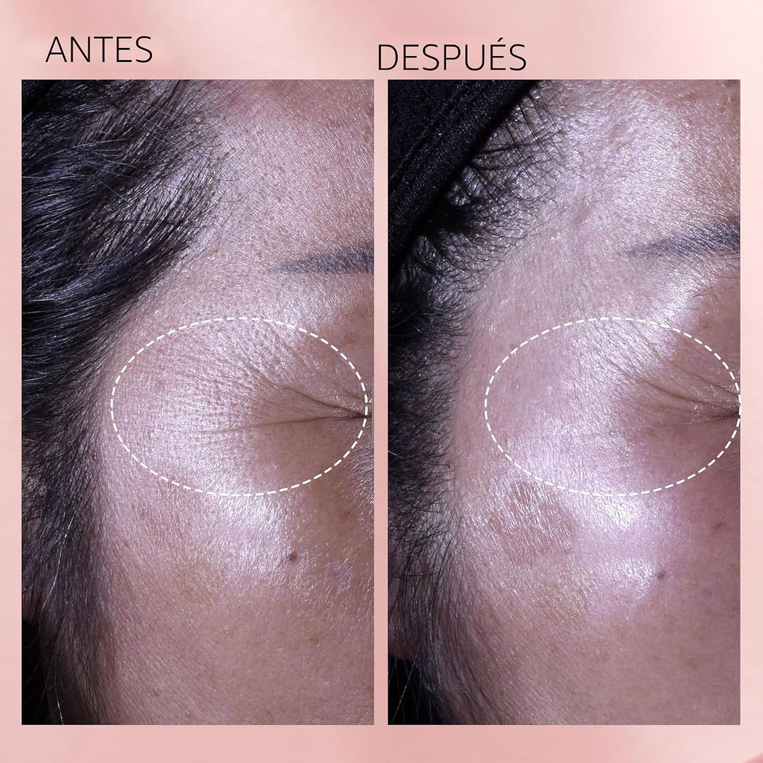 Cápsulas de suero facial de retinol + HPR de ceramidas de Elizabeth...