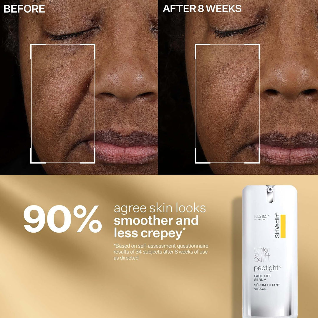 StriVectin Tighten & Lift Peptight Face Lift Serum con péptidos ten...