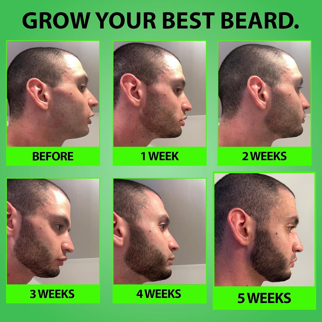 Minoxidil para el crecimiento de la barba: suero al 5% con 2 veces...