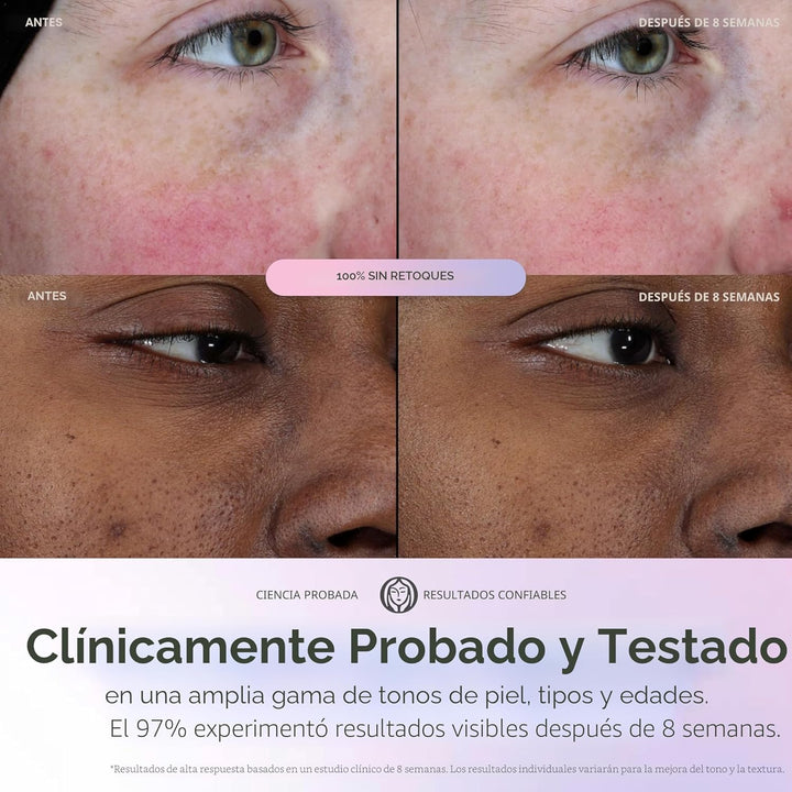 Olay Super Serum - Niacinamida, Vitamina C y E, péptido de colágeno...