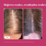 Viviscal - Suplementos para el crecimiento del cabello para mujer p...