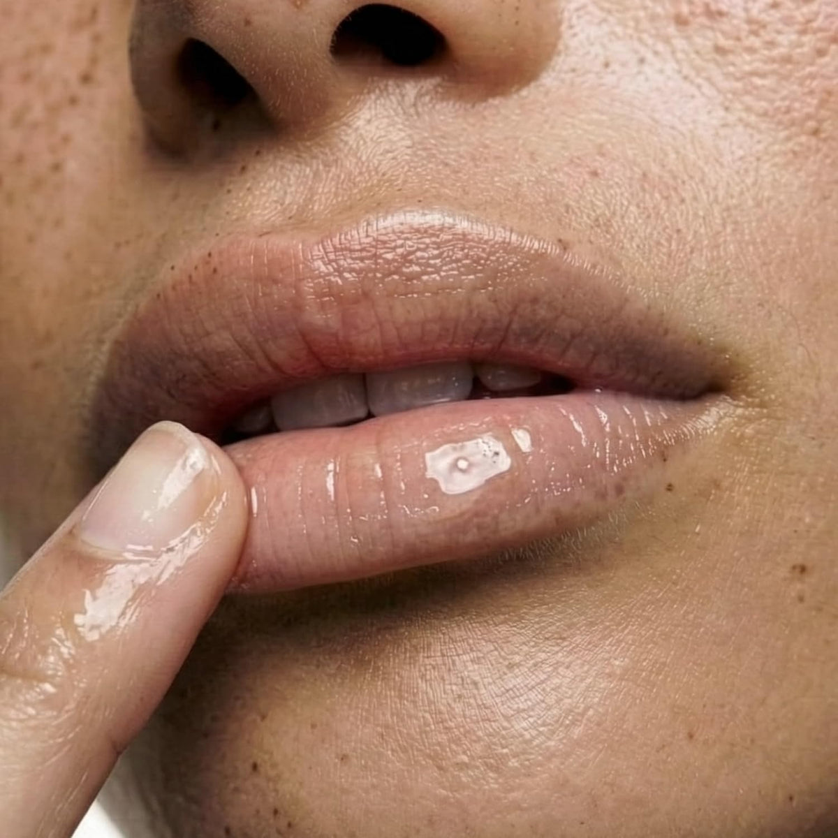 MARK Los Angeles | Suero de rescate de labios | Complejo flavonoide...