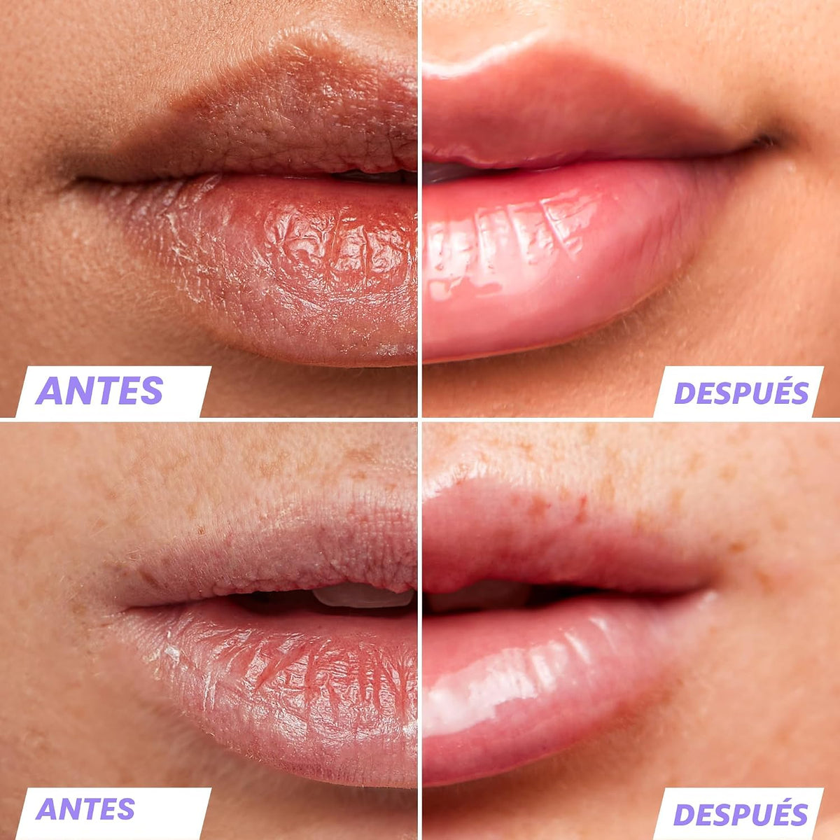 Wonderskin Aceite de labios - Aceite de suero de rehabilitación lab...