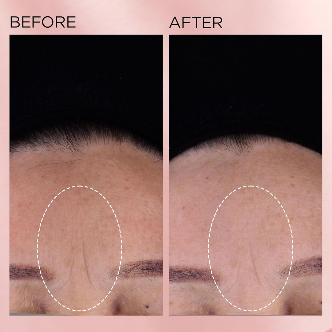 Cápsulas de suero facial de retinol + HPR de ceramidas de Elizabeth...