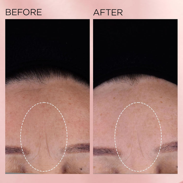Cápsulas de suero facial de retinol + HPR de ceramidas de Elizabeth...