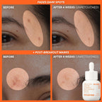 innisfree Vitamina C Rapid Radiance Set, juego coreano de cuidado d...