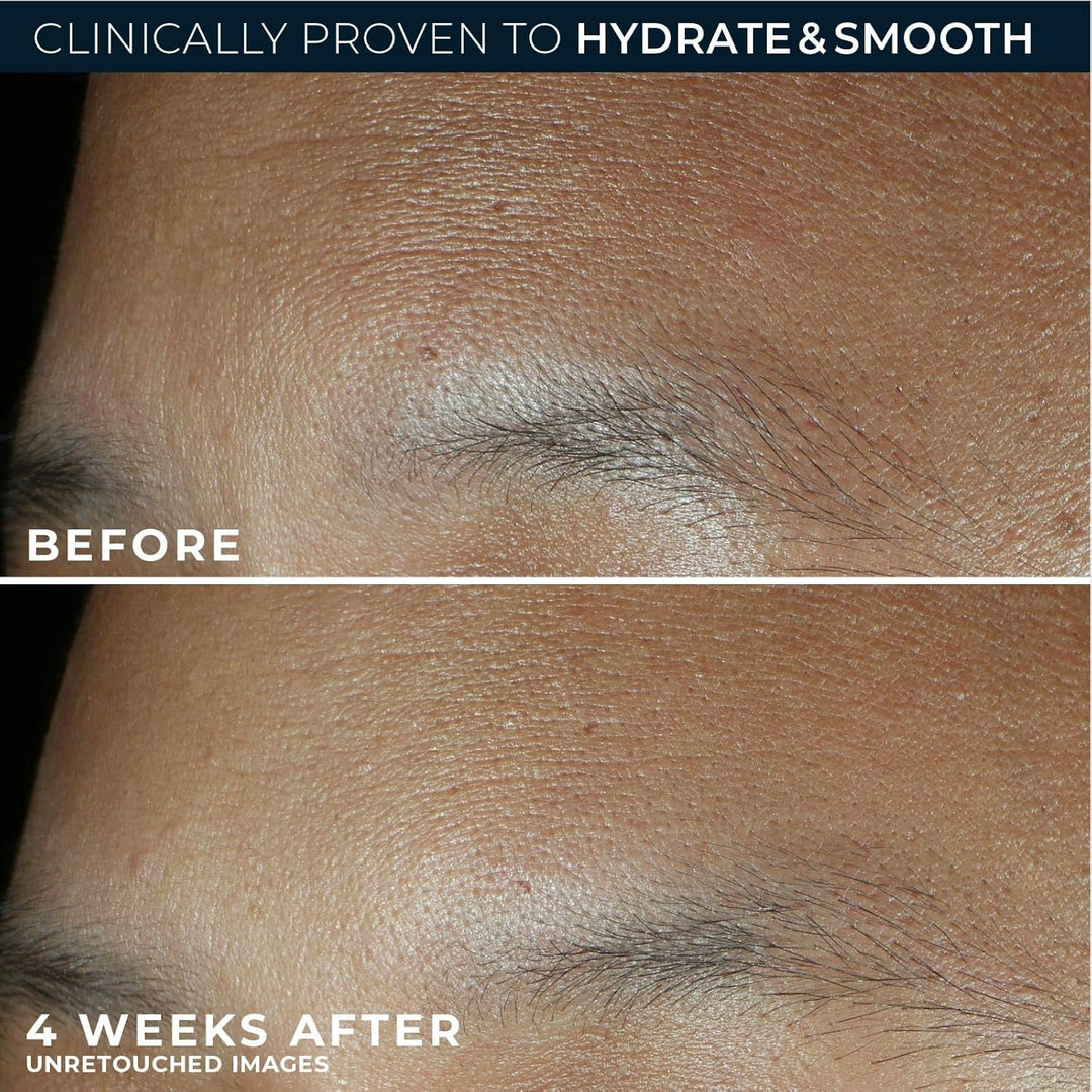 RoC Retinol Correxion Max Hydration - Hidratante facial diario anti...