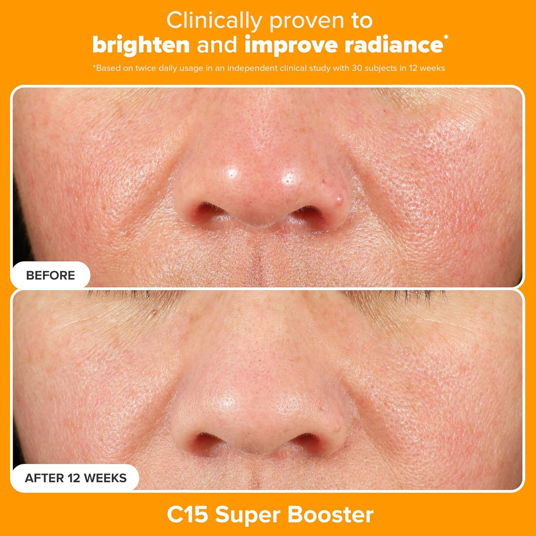 Paula's Choice BOOST C15 Super Booster, 15% Vitamin C Serum for...