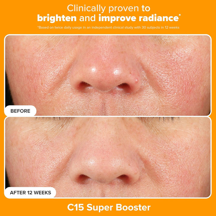Paula's Choice BOOST C15 Super Booster, 15% Vitamin C Serum for...