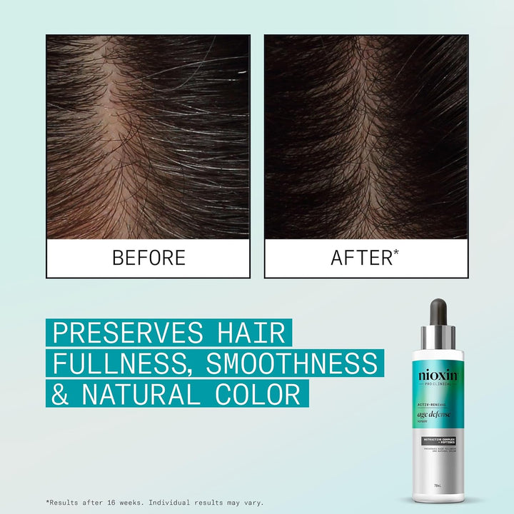 Nioxin Age Defense Kit antienvejecimiento | Limpiador desintoxicant...