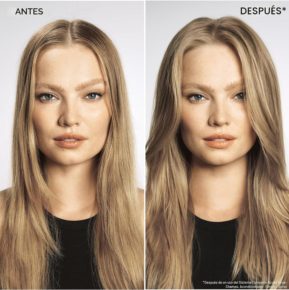 Redken Acidic Grow Full System - Suero para el cuero cabelludo y el...