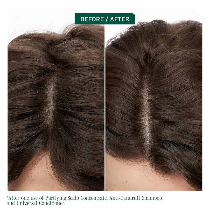 Biolage Scalp Sync Anti-Dandruff Shampoo - Controls Itchy Scalp, De...